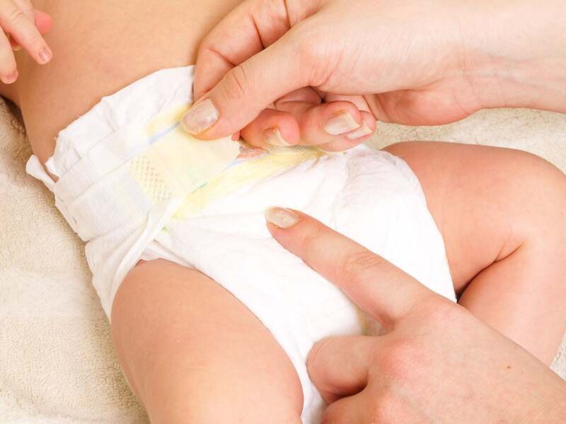 Những cách dùng bỉm cho trẻ sơ sinh không bị hăm
